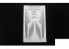 Boogie Body Stripes for 1985 Toyota 4Runner Hard Body RC4WD